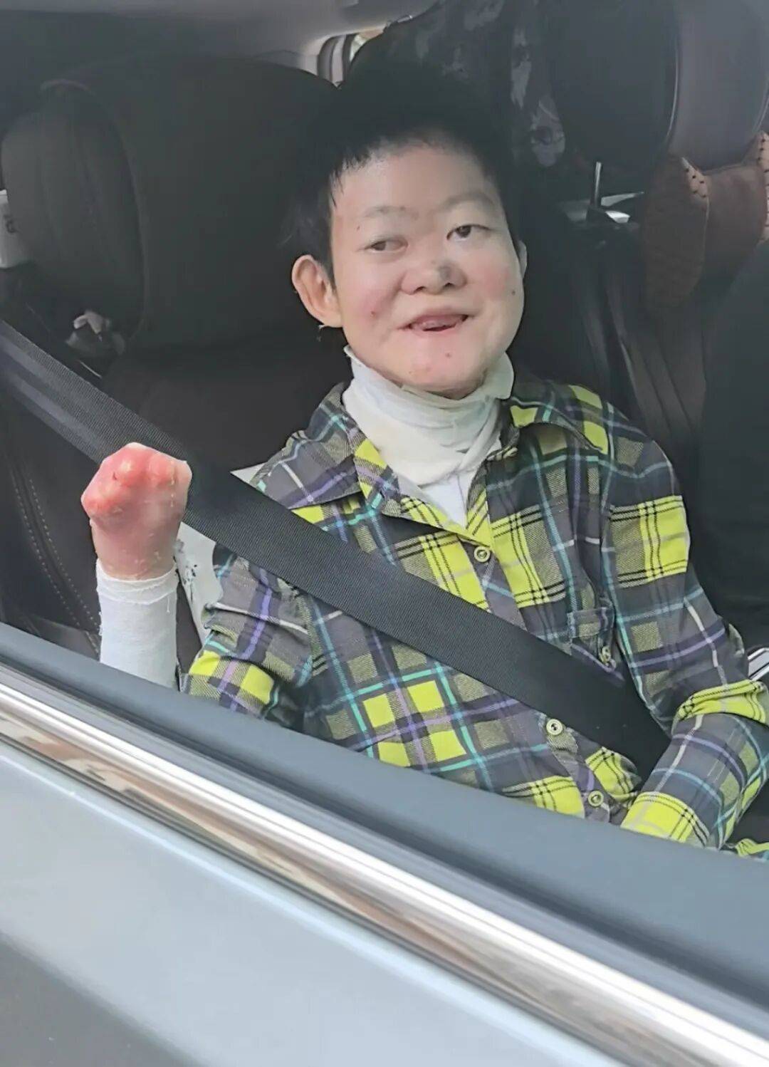 醫(yī)生斷言“活不過2歲”的鄭州罕見病女孩，24歲“帶傷出征”，開啟西藏之行:機(jī)械制造
